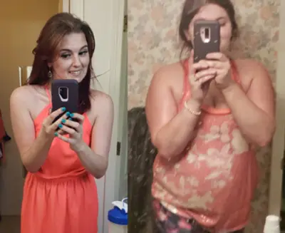 Ashley's Bio Complete 3 Before and After real result